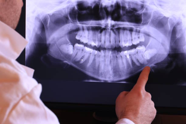 Best Emergency Dental Filling Replacement  in Duluth, GA