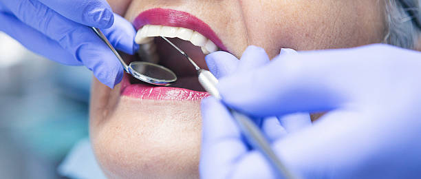 Best Broken Tooth Emergency  in Duluth, GA